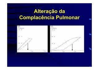 Alteração da
Complacência Pulmonar
 