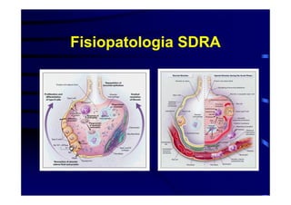 Fisiopatologia SDRA
 