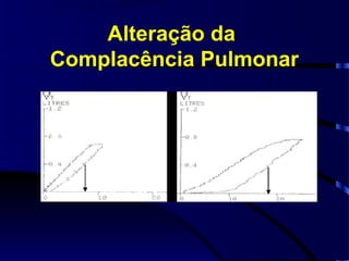 Alteração da
Complacência Pulmonar
 