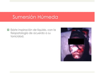 Sumersión Húmeda
 Existe inspiración de líquido, con la
fisiopatología de acuerdo a su
tonicidad.
 
