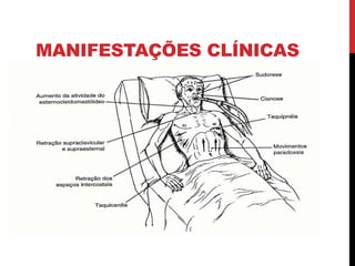 MANIFESTAÇÕES CLÍNICAS
 