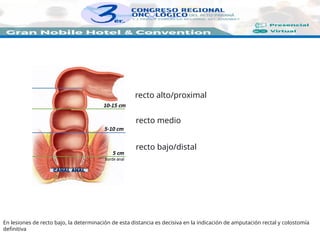 recto bajo/distal
recto medio
recto alto/proximal
En lesiones de recto bajo, la determinación de esta distancia es decisiva en la indicación de amputación rectal y colostomía
definitiva
 