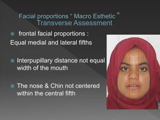  frontal facial proportions :
Equal medial and lateral fifths
 Interpupillary distance not equal
width of the mouth
 The nose & Chin not centered
within the central fifth
Transverse Assessment
 