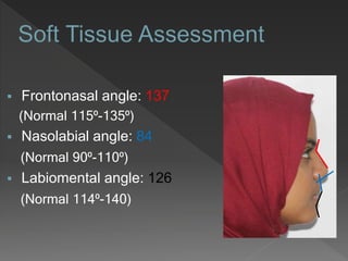  Frontonasal angle: 137
(Normal 115⁰-135⁰)
 Nasolabial angle: 84
(Normal 90⁰-110⁰)
 Labiomental angle: 126
(Normal 114⁰-140)
 
