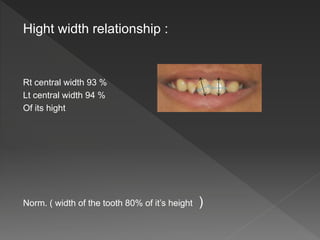 Hight width relationship :
Rt central width 93 %
Lt central width 94 %
Of its hight
Norm. ( width of the tooth 80% of it’s height )
 