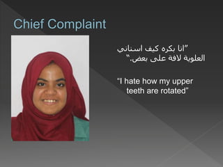 ”‫اسناني‬ ‫كيف‬ ‫بكره‬ ‫انا‬
‫بعض‬ ‫على‬ ‫الفة‬ ‫العلوية‬.“
“I hate how my upper
teeth are rotated”
 