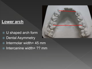 Lower arch
 U shaped arch form
 Dental Asymmetry
 Intermolar width= 45 mm
 Intercanine width= ?? mm
 
