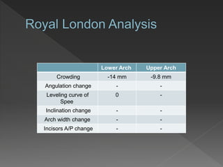 Upper ArchLower Arch
-9.8 mm-14 mmCrowding
--Angulation change
-0Leveling curve of
Spee
--Inclination change
--Arch width change
--Incisors A/P change
 