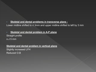  Skeletal and dental problems in transverse plane :
Lower midline shifted to rt 3mm and upper midline shifted to left by 3 mm
 Skeletal and dental problem in A-P plane
Straight profile
o.J 5 mm
Skeletal and dental problem in vertical plane
Slightly increased LFH
Reduced O.B
 