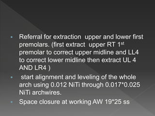  Referral for extraction upper and lower first
premolars. (first extract upper RT 1st
premolar to correct upper midline and LL4
to correct lower midline then extract UL 4
AND LR4 )
 start alignment and leveling of the whole
arch using 0.012 NiTi through 0.017*0.025
NiTi archwires.
 Space closure at working AW 19*25 ss
 