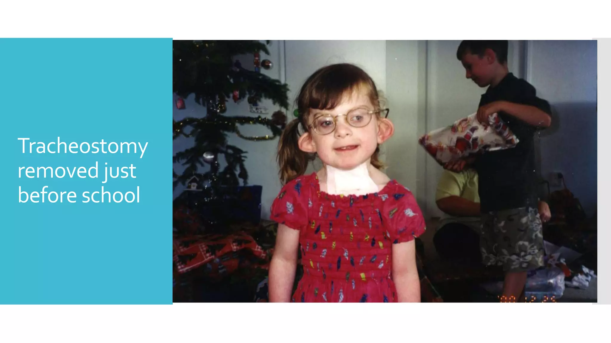 Sarah Dalton - Charge Syndrome | PPTX