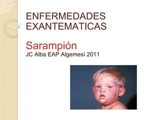 ENFERMEDADES EXANTEMATICAS Sarampión  JC Alba EAP Algemesí 2011 