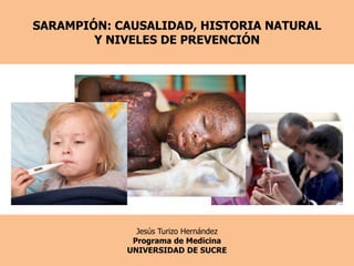 SARAMPIÓN: CAUSALIDAD, HISTORIA NATURAL
Y NIVELES DE PREVENCIÓN
Jesús Turizo Hernández
Programa de Medicina
UNIVERSIDAD DE SUCRE
 