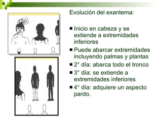 Evolución del exantema: Inicio en cabeza y se extiende a extremidades inferiores Puede abarcar extremidades incluyendo palmas y plantas 2 °  día: abarca todo el tronco 3 ° día: se extiende a extremidades inferiores 4° día: adquiere un aspecto pardo. 