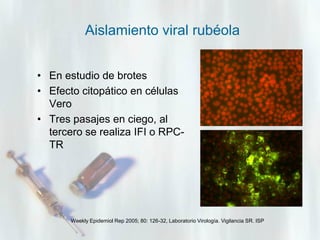 Aislamiento viral rubéola
• En estudio de brotes
• Efecto citopático en células
Vero
• Tres pasajes en ciego, al
tercero se realiza IFI o RPCTR

Weekly Epidemiol Rep 2005; 80: 126-32, Laboratorio Virología. Vigilancia SR. ISP

 