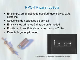RPC-TR para rubéola
• En sangre, orina, aspirado nasofaríngeo, saliva, LCR,
cristalino
• Secuencia de nucleótido de gen E1
• En saliva los primeros 7 días de enfermedad
• Positivo solo en 16% si síntomas menor a 7 días
• Permite la genotipificación

J Clin Virol 2003; 27: 205-9, Mol Cell Probe 2002; 16: 93-7

 