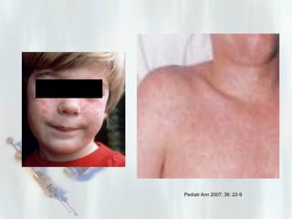 Pediatr Ann 2007; 36: 22-9

 