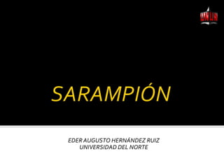 SARAMPIÓN EDER AUGUSTO HERNÁNDEZ RUIZ UNIVERSIDAD DEL NORTE 