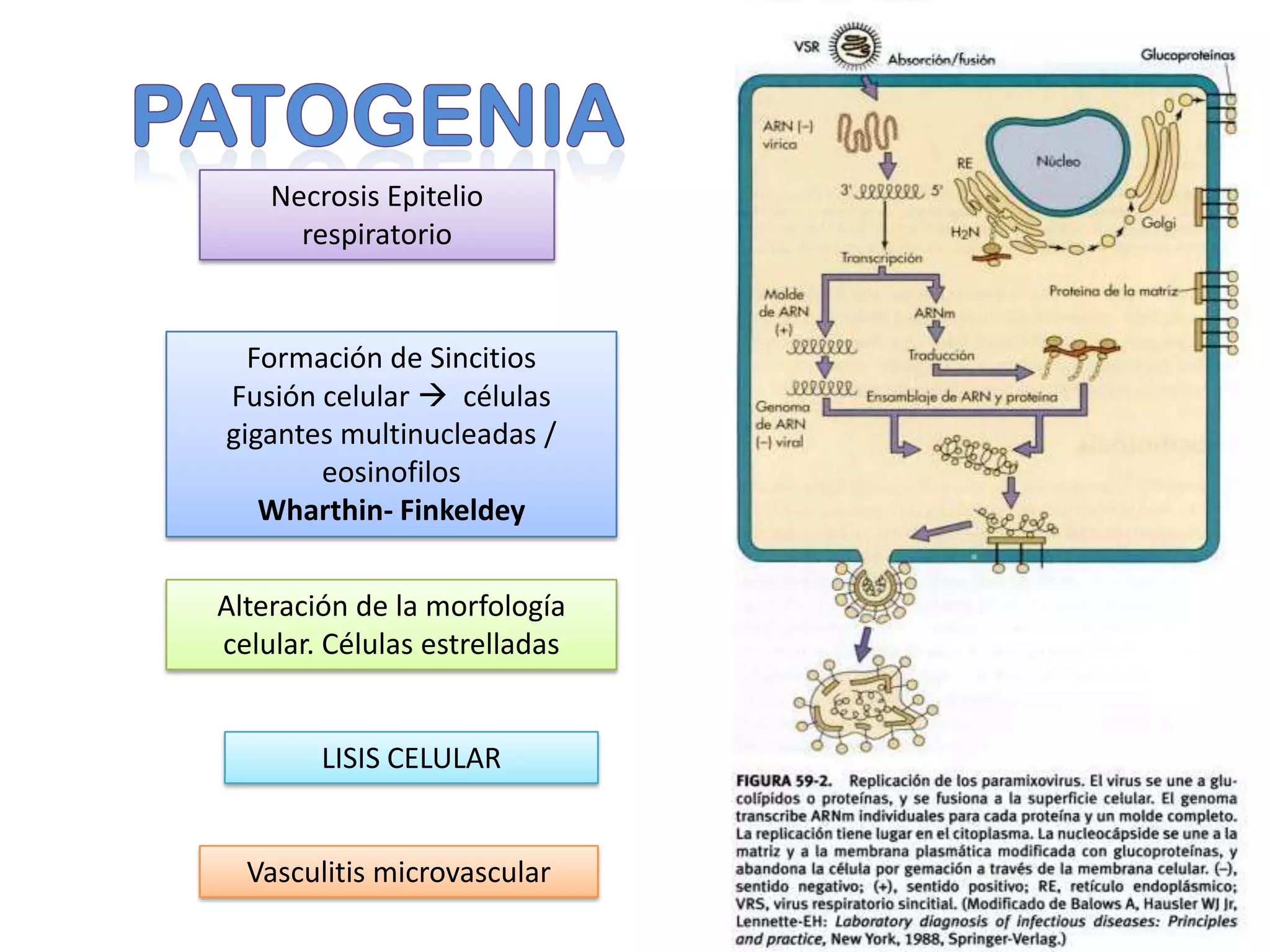 Formación de Sincitios
Fusión celular  células
gigantes multinucleadas /
eosinofilos
Wharthin- Finkeldey
Alteración de la morfología
celular. Células estrelladas
LISIS CELULAR
Necrosis Epitelio
respiratorio
Vasculitis microvascular
 
