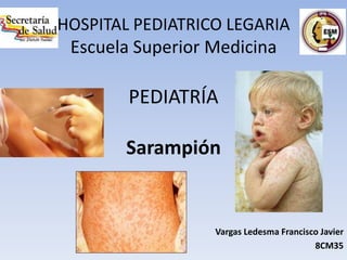 HOSPITAL PEDIATRICO LEGARIA
Escuela Superior Medicina
PEDIATRÍA
Sarampión
Vargas Ledesma Francisco Javier
8CM35
 