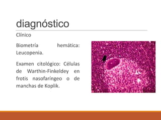 diagnóstico
Clínico
Biometría hemática:
Leucopenia.
Examen citológico: Células
de Warthin-Finkeldey en
frotis nasofaríngeo o de
manchas de Koplik.
 