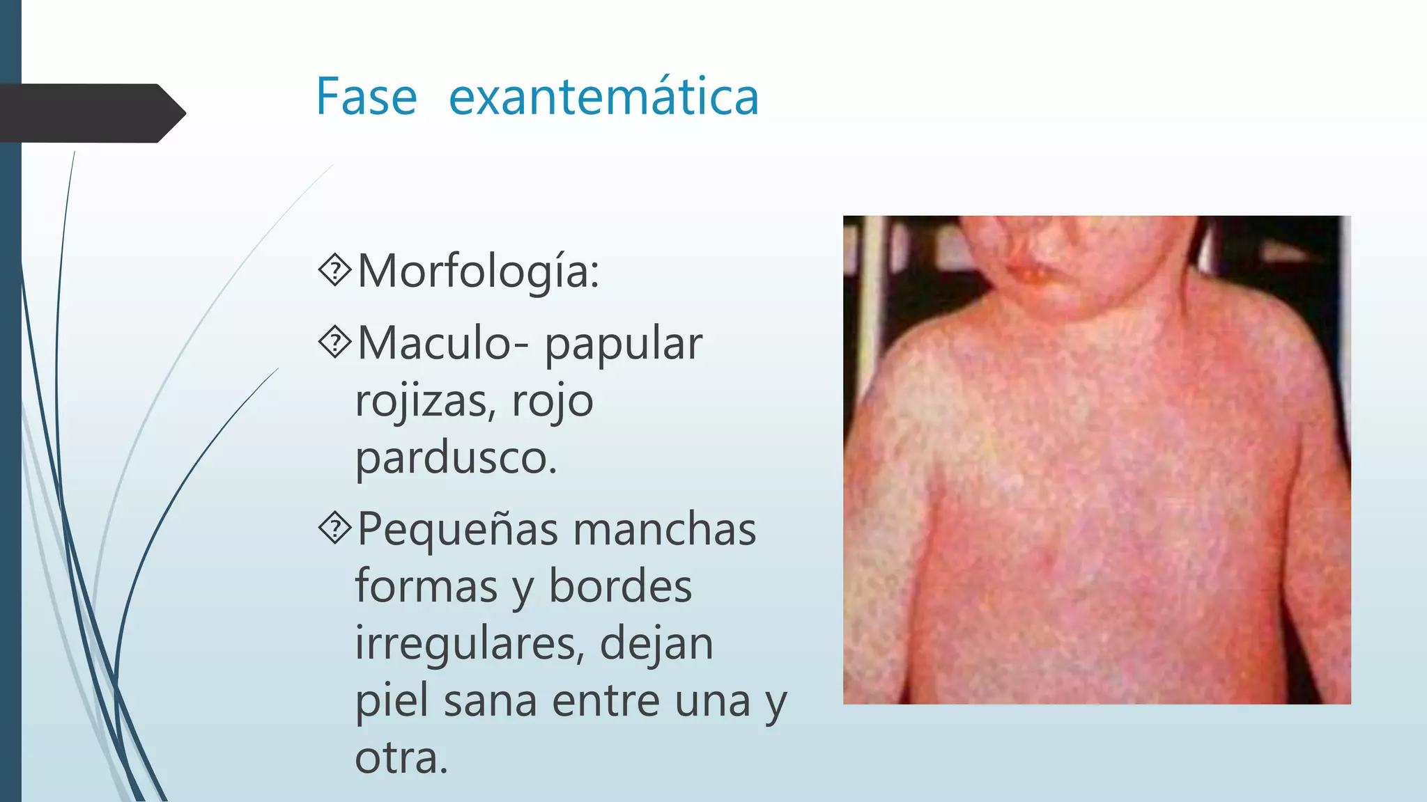 Fase exantemática
Morfología:
Maculo- papular
rojizas, rojo
pardusco.
Pequeñas manchas
formas y bordes
irregulares, dejan
piel sana entre una y
otra.
 