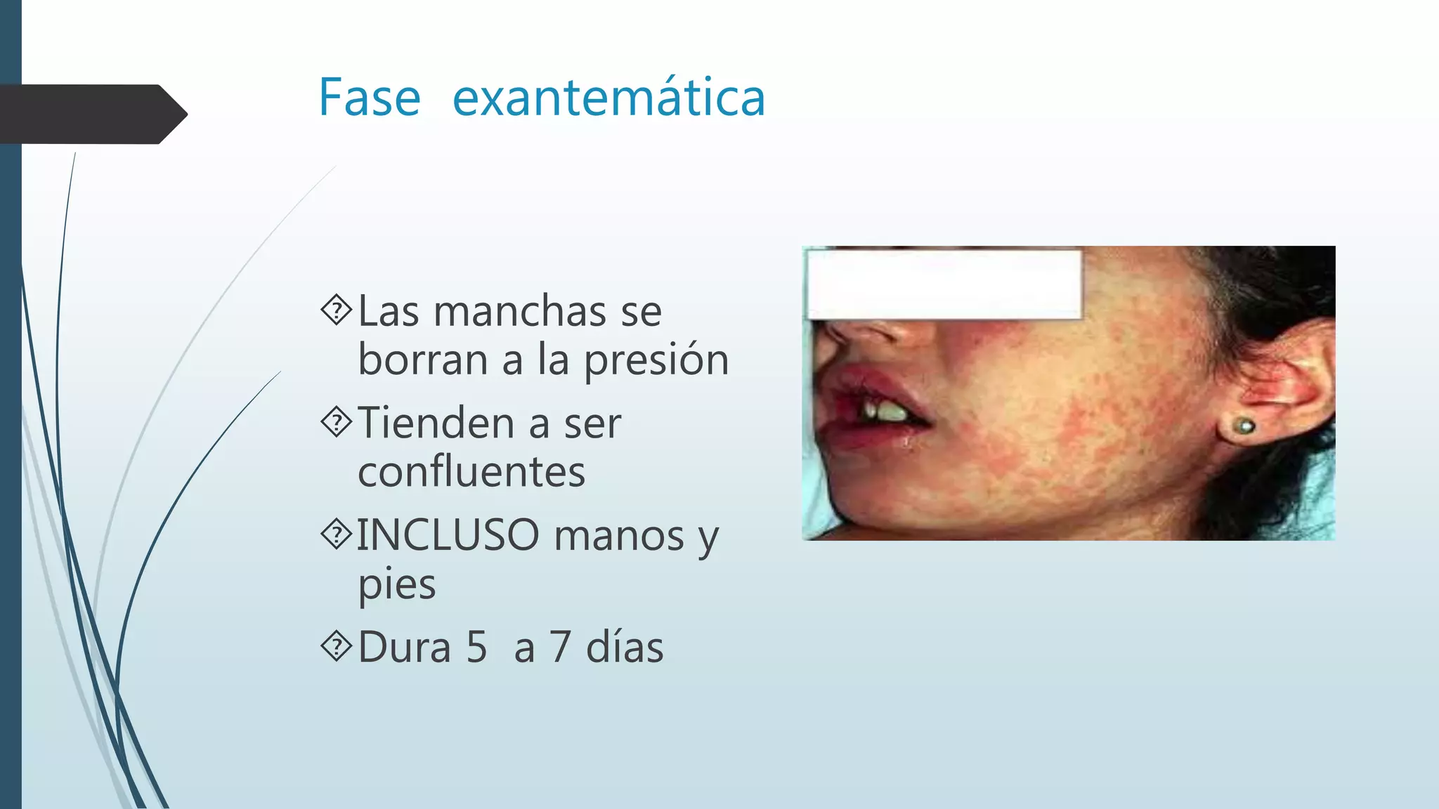 Fase exantemática
Las manchas se
borran a la presión
Tienden a ser
confluentes
INCLUSO manos y
pies
Dura 5 a 7 días
 