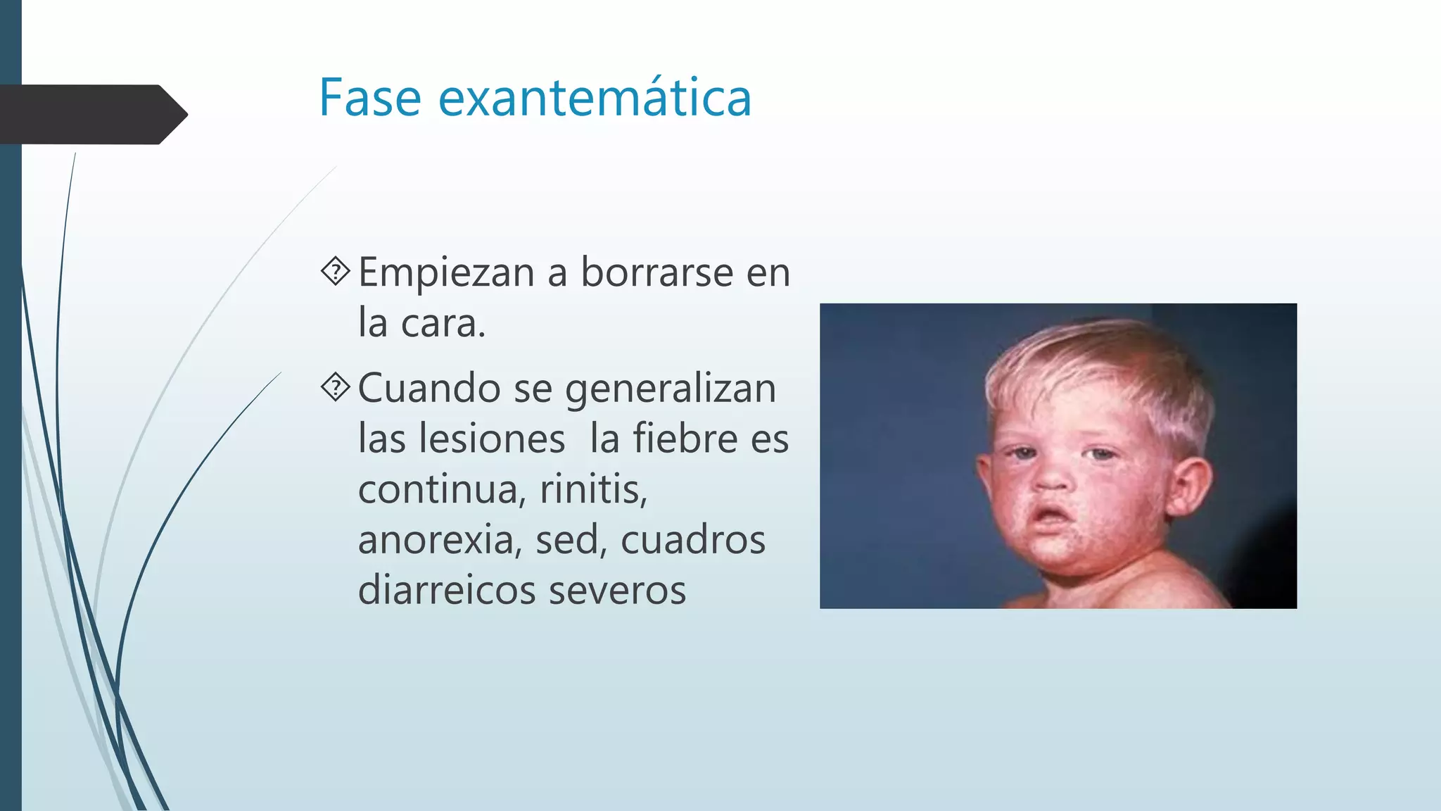 Fase exantemática
Empiezan a borrarse en
la cara.
Cuando se generalizan
las lesiones la fiebre es
continua, rinitis,
anorexia, sed, cuadros
diarreicos severos
 