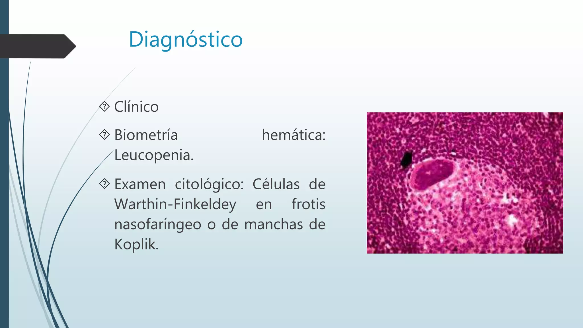 Diagnóstico
 Clínico
 Biometría hemática:
Leucopenia.
 Examen citológico: Células de
Warthin-Finkeldey en frotis
nasofaríngeo o de manchas de
Koplik.
 