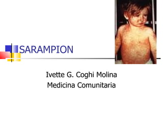 SARAMPION Ivette G. Coghi Molina Medicina Comunitaria 