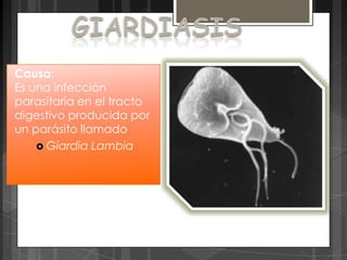 Causa:
Es una infección
parasitaria en el tracto
digestivo producida por
un parásito llamado
     Giardia Lambia
 