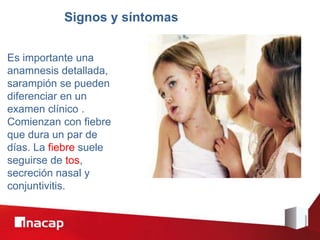 Signos y síntomas
Es importante una
anamnesis detallada,
sarampión se pueden
diferenciar en un
examen clínico .
Comienzan con fiebre
que dura un par de
días. La fiebre suele
seguirse de tos,
secreción nasal y
conjuntivitis.
 