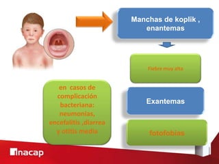 Exantemas
Manchas de koplik ,
enantemas
fotofobias
en casos de
complicación
bacteriana:
neumonías,
encefalitis ,diarrea
y otitis media
Fiebre muy alta
 