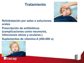 Tratamiento
Rehidratación por sales o soluciones
orales
Prescripción de antibióticos
(complicaciones como neumonía,
infecciones oticas y oculares.)
Suplementos de vitamina A (400.000 u)
oral
 