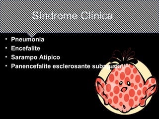 Síndrome Clínica 
• Pneumonia 
• Encefalite 
• Sarampo Atípico 
• Panencefalite esclerosante subaguda 
 
