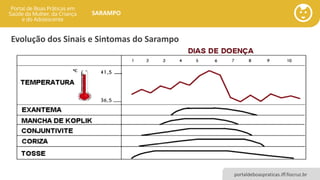 portaldeboaspraticas.iff.fiocruz.br
SARAMPO
Evolução dos Sinais e Sintomas do Sarampo
 