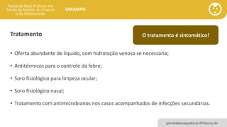portaldeboaspraticas.iff.fiocruz.br
SARAMPO
Tratamento
• Oferta abundante de líquido, com hidratação venosa se necessária;
• Antitérmicos para o controle da febre;
• Soro fisiológico para limpeza ocular;
• Soro fisiológico nasal;
• Tratamento com antimicrobianos nos casos acompanhados de infecções secundárias.
O tratamento é sintomático!
 