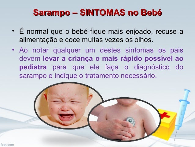 Image Result For Sarampo Image Result For Sarampo