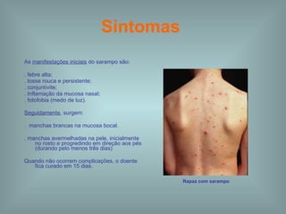 Sintomas   As  manifestações iniciais  do sarampo são: . febre alta; . tosse rouca e persistente; . conjuntivite; . Inflamação da mucosa nasal; . fotofobia (medo de luz). Seguidamente , surgem: .  manchas brancas na mucosa bocal. . manchas avermelhadas na pele, inicialmente no rosto e progredindo em direção aos pés (durando pelo menos três dias) Quando não ocorrem complicações, o doente fica curado em 15 dias.  Rapaz com sarampo 