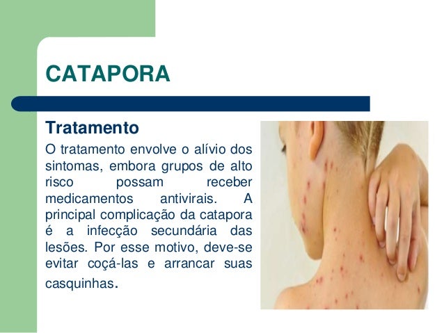 Sarampo e catapora