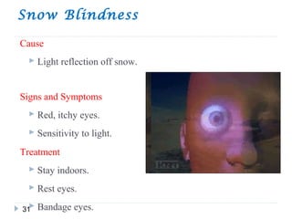 Snow Blindness
31
Cause
 Light reflection off snow.
Signs and Symptoms
 Red, itchy eyes.
 Sensitivity to light.
Treatment
 Stay indoors.
 Rest eyes.
 Bandage eyes.
 
