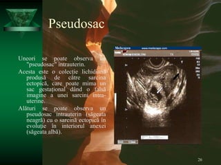 26
Pseudosac
Uneori se poate observa un
"pseudosac" intrauterin.
Acesta este o colecție lichidiană
produsă de către sarcina
ectopică, care poate mima un
sac gestațional dând o falsă
imagine a unei sarcini intra-
uterine.
Alături se poate observa un
pseudosac intrauterin (săgeata
neagră) cu o sarcină ectopică în
evoluție în interiorul anexei
(săgeata albă).
 