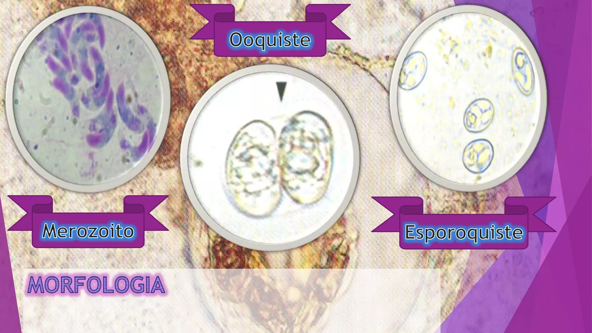 Sarcocystis bovihominis