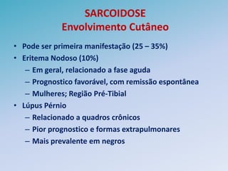 SARCOIDOSE
             Envolvimento Cutâneo
• Pode ser primeira manifestação (25 – 35%)
• Eritema Nodoso (10%)
   – Em geral, relacionado a fase aguda
   – Prognostico favorável, com remissão espontânea
   – Mulheres; Região Pré-Tibial
• Lúpus Pérnio
   – Relacionado a quadros crônicos
   – Pior prognostico e formas extrapulmonares
   – Mais prevalente em negros
 