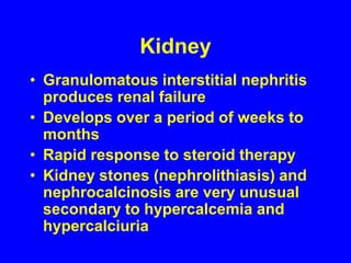 KidneyGranulomatous interstitial nephritis produces renal failureDevelops over a period of weeks to monthsRapid response to steroid therapyKidney stones (nephrolithiasis) and nephrocalcinosis are very unusual secondary to hypercalcemia and hypercalciuria