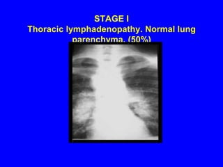 Non Specific-Hodgkins,histoplasma,leprosy