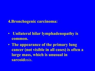    2. Pulmonary tuberculosis: Nodal enlargement   is unilateral in about 80% of tuberculosis cases.