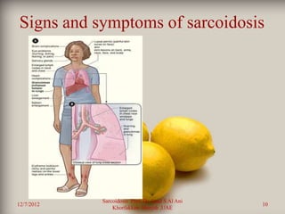 Signs and symptomsof sarcoidosis
Signs  and symptoms of sarcoidosis
            •




                Sarcoidosis Prof. Dr. Saad S Al Ani
12/7/2012                                             10
                    Khorfakkan .Sharjah ,UAE
 