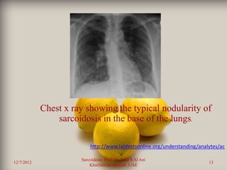 Chest x ray showing the typical nodularity of
                sarcoidosis in the base of the lungs.

                          http://www.labtestsonline.org/understanding/analytes/ac

                      Sarcoidosis Prof. Dr. Saad S Al Ani
12/7/2012                                                                 13
                          Khorfakkan .Sharjah ,UAE
 