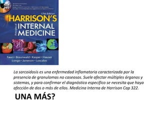 UNA MÁS?
La sarcoidosis es una enfermedad inflamatoria caracterizada por la
presencia de granulomas no caseosos. Suele afectar múltiples órganos y
sistemas, y para confirmar el diagnóstico específico se necesita que haya
afección de dos o más de ellos. Medicina Interna de Harrison Cap 322.
 